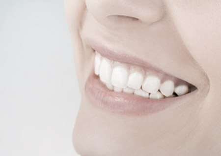 Blanchiement des dents